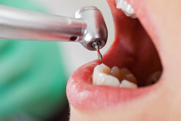 Best Root Canal Emergency Dentist  in Emerald Lakes, PA